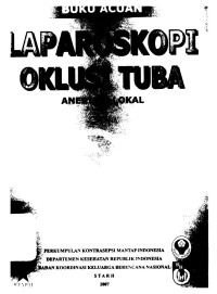 Buku Acuan Laparoskopi Oklusi Tuba Anastesi Lokal